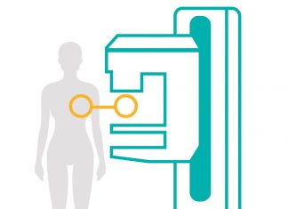 North Memorial Health Breast Center Now Offers 3D Mammography Illustration of mammography machine. North Memorial Health Breast Center now offers 3D mammography
