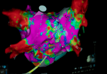 Leading with Heart in Women’s Health heart scan
