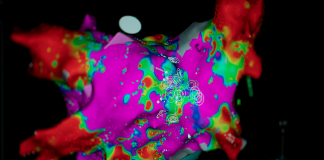 Leading with Heart in Women’s Health heart scan